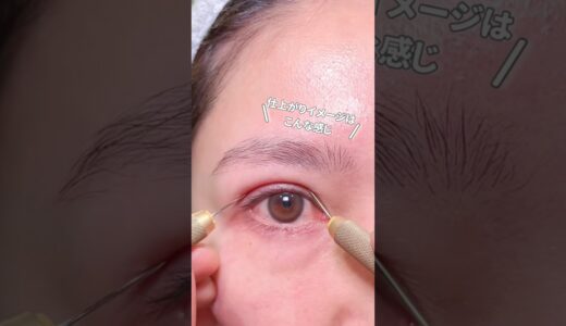 【スタッフ施術】#埋没#恵聖会クリニック#美容整形 #目元#shorts#美容