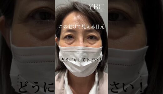 【クマ治療/目の下のたるみ】先生、私お願いがあります。この老けて見える目元どうにかしてください #shorts
