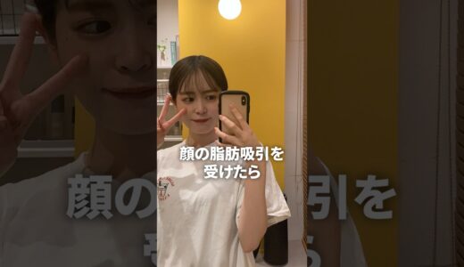 脂肪吸引の失敗から立ち直るまでの3年間まとめ　#shorts