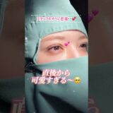 【スタッフの埋没オペに密着👀💕】 #美容整形 #二重整形 #二重埋没