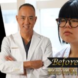 【整形密着BeforeAfter】美しくなるために努力したが自分では限界！全身プロデュース！重たい目、顔の余白を減らして卵型の顔に【ドクターA（東京美容外科）】