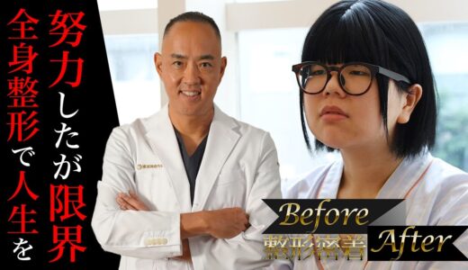 【整形密着BeforeAfter】美しくなるために努力したが自分では限界！全身プロデュース！重たい目、顔の余白を減らして卵型の顔に【ドクターA（東京美容外科）】