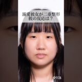【二重整形】溺愛彼女が二重整形！彼の反応は？#shorts
