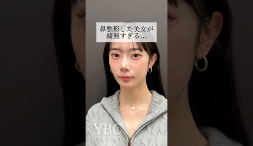 【衝撃】鼻整形した美女が綺麗すぎる… #美容整形 #鼻整形 #ybc横浜美容外科
