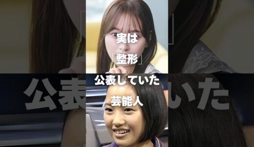 【注目】実は「整形」を公表していた芸能人まとめ#shorts #芸能人 #芸能