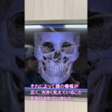 頬骨骨切りは実際どうやるの？ CTを見ながら簡単に解説（リッツ美容外科 副院長 永井 宏治）