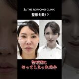 【フル整形したら失敗に！？】「整形顔になってしまった場合、修正することはできるのか？」そんな疑問にお答えします。出来ます✨　#美容クリニック #美容皮膚科 #美容外科　#ヒアルロン酸