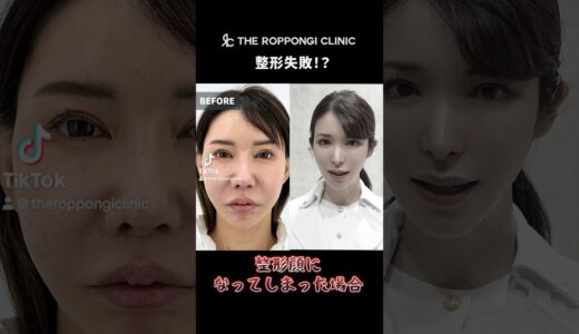 【フル整形したら失敗に！？】「整形顔になってしまった場合、修正することはできるのか？」そんな疑問にお答えします。出来ます✨　#美容クリニック #美容皮膚科 #美容外科　#ヒアルロン酸