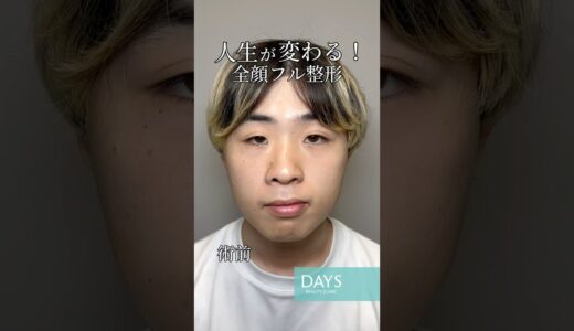 【全顔フル整形】人生が変わる整形？#shorts