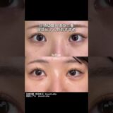 垢抜ける美容整形はこれ！