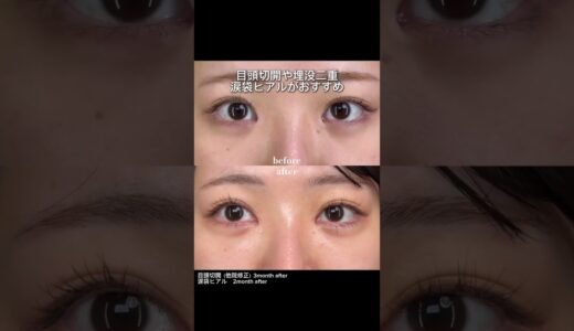 垢抜ける美容整形はこれ！