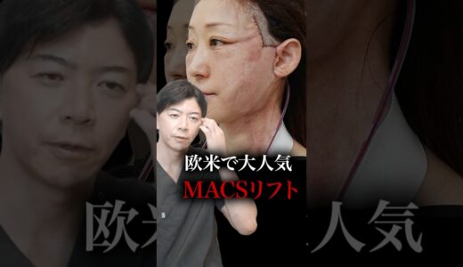 欧米で人気なMACSリフト術後解説＃フェイスリフト＃MACSリフト