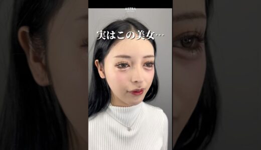 【実はこちらの美女…🤫🌹#astrabeautyclinic#鼻整形#塩満恵子#渋谷#美容整形】