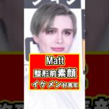 Mattの美容整形前の素顔がイケメン好青年で衝撃！　#雑学 #芸能人 #プチ知識 #美容 #整形 #Matt