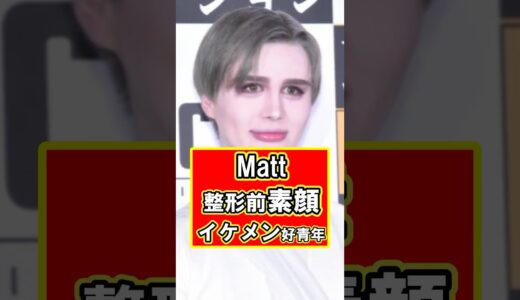 Mattの美容整形前の素顔がイケメン好青年で衝撃！　#雑学 #芸能人 #プチ知識 #美容 #整形 #Matt