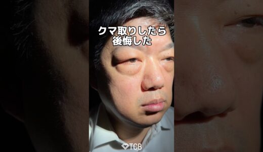 【クマ取り】クマ取りしたら後悔しました。#shorts