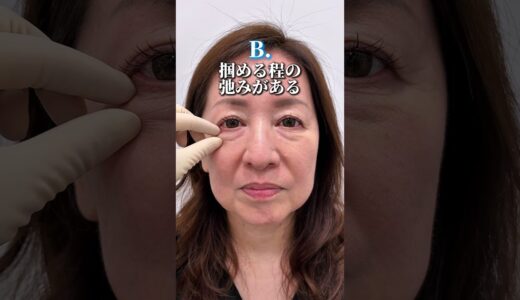 【クマ取り】あなたはどっちが適応？#shorts