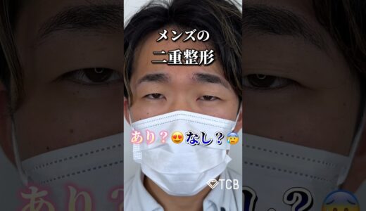 【二重整形】メンズの二重整形あり？なし？#二重整形#二重埋没#末広二重#目頭切開#ダウンタイム#蒙古襞#まぶた重い#腫れ#アイプチ#TCB#shorts