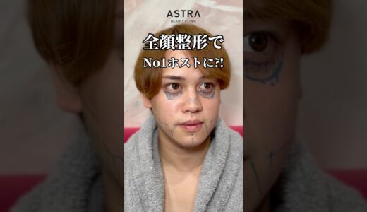 ホストの全顔整形👩🏼‍⚕️💖#astrabeautyclinic  #アストラビューティークリニック #塩満恵子 #鼻整形 #美容整形 #忘れ鼻
